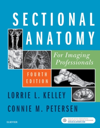 Cover image: Sectional Anatomy for Imaging Professionals 4th edition 9780323414876