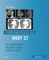 Titelbild: Fundamentals of Body CT 5th edition 9780323608329