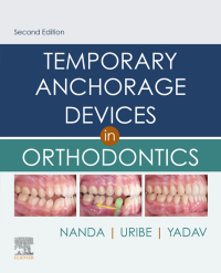 Immagine di copertina: Temporary Anchorage Devices in Orthodontics 2nd edition 9780323609333