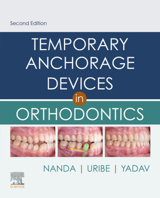 Cover image: Temporary Anchorage Devices in Orthodontics 2nd edition 9780323609333
