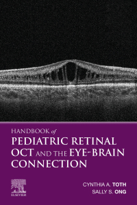 Titelbild: Handbook of Pediatric Retinal OCT and the Eye-Brain Connection 9780323609845