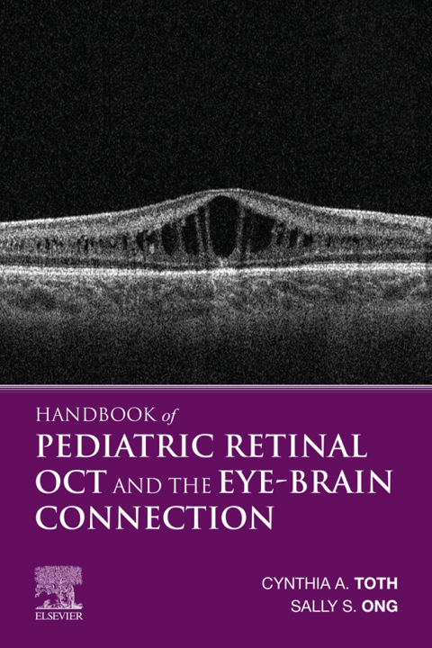 Handbook of Pediatric Retinal OCT and the Eye-Brain Connection - FULL INSTANT DOWNLOAD | PDF DOCX EPUB