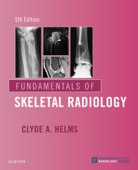 Cover image: Fundamentals of Skeletal Radiology 5th edition 9780323611657