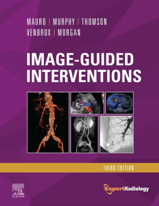 Cover image: Image-Guided Interventions E-Book 3rd edition 9780323612043