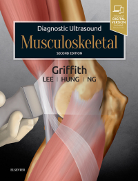 Imagen de portada: Diagnostic Ultrasound: Musculoskeletal 2nd edition 9780323570138
