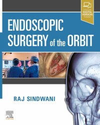 Cover image: Endoscopic Surgery of the Orbit 9780323613293