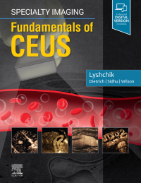 Cover image: Specialty Imaging: Fundamentals of CEUS 9780323625647