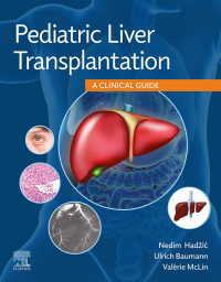صورة الغلاف: Pediatric Liver Transplantation 9780323636711
