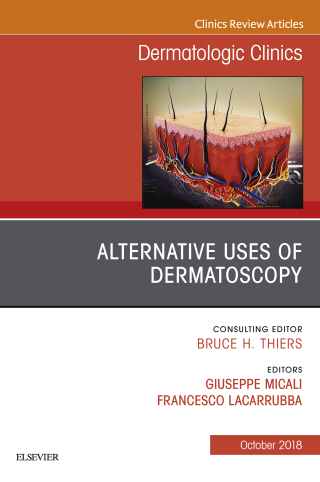 Cover image: Alternative Uses of Dermatoscopy, An Issue of Dermatologic Clinics 9780323641234