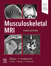 Imagen de portada: Musculoskeletal MRI 3rd edition 9780323415606
