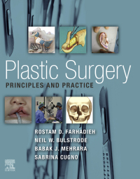 صورة الغلاف: Plastic Surgery - Principles and Practice 9780323653817