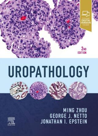 Cover image: Uropathology 2nd edition 9780323653954