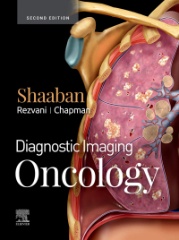 Titelbild: Diagnostic Imaging: Oncology 2nd edition 9780323661126