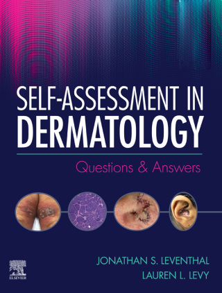 Imagen de portada: Self-Assessment in Dermatology 9780323662000