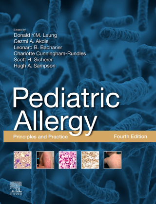 Immagine di copertina: Pediatric Allergy 4th edition 9780323674621