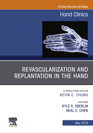 Imagen de portada: Revascularization and Replantation in the Hand, An Issue of Hand Clinics 9780323678438