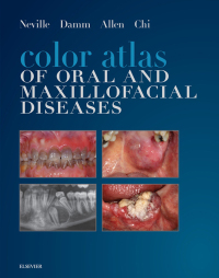 صورة الغلاف: Color Atlas of Oral and Maxillofacial Diseases - E-Book 9780323552257