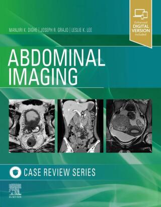 Cover image: Abdominal Imaging 9780323679848