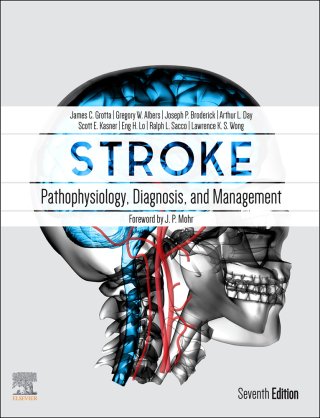 Cover image: Stroke 7th edition 9780323694247