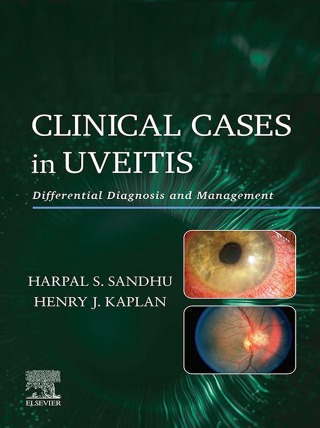 Cover image: Clinical Cases in Uveitis 9780323695411