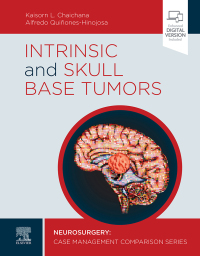 Titelbild: Intrinsic and Skull Base Tumors 9780323696425