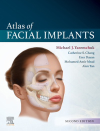 Cover image: Atlas of Facial Implants 2nd edition 9780323624763