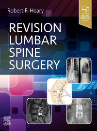 Imagen de portada: Revision Lumbar Spine Surgery 9780323712019