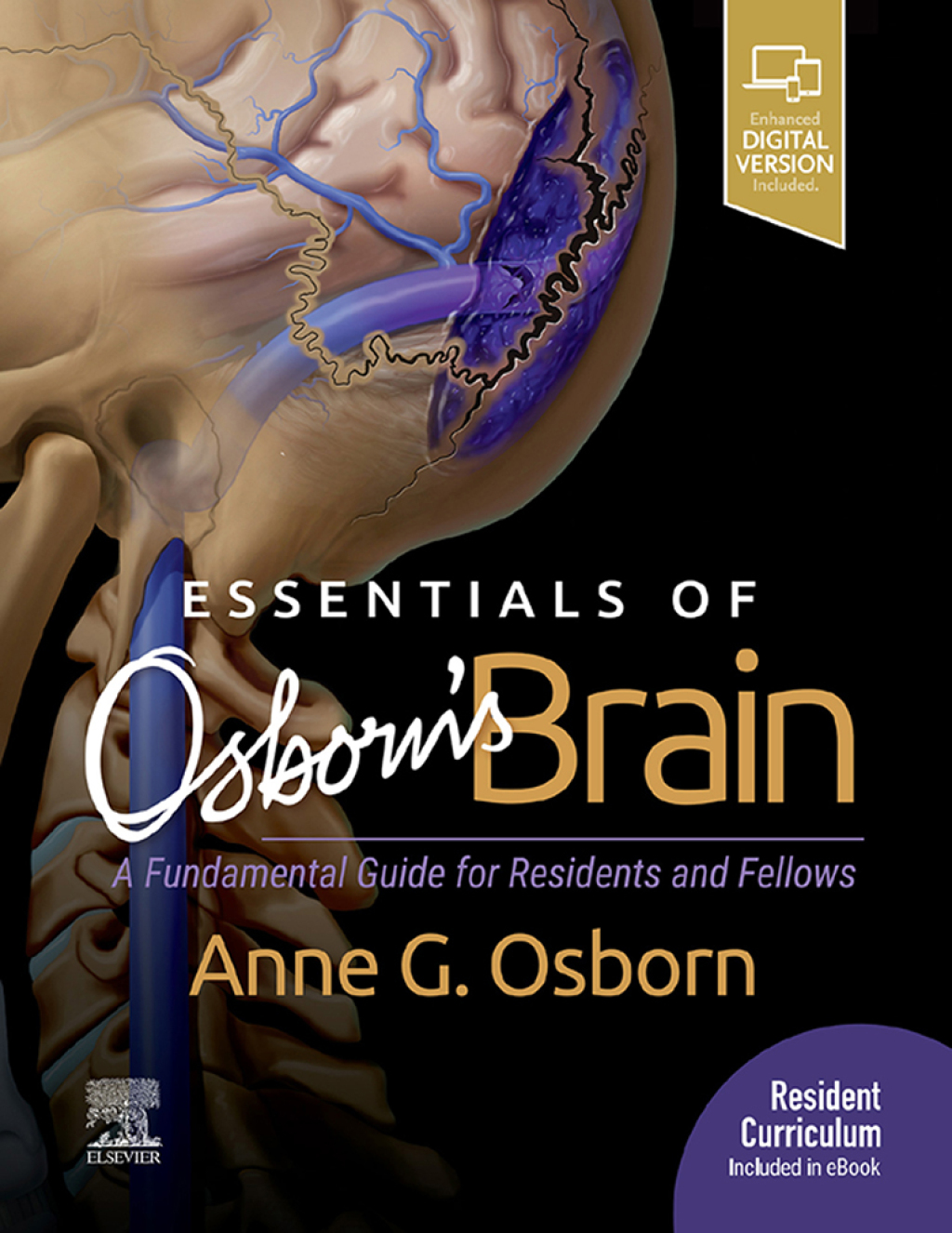 Essentials of Osborn’s Brain A Fundamental Guide for Residents and Fellows