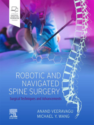 表紙画像: Robotic and Navigated Spine Surgery E-Book 9780323711609