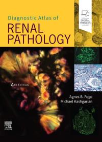 表紙画像: Diagnostic Atlas of Renal Pathology 4th edition 9780323721639
