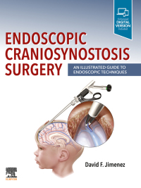 صورة الغلاف: Endoscopic Craniosynostosis Surgery E-Book 9780323721752