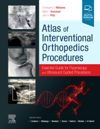 Cover image: Atlas of Interventional Orthopedics Procedures, E-Book 9780323755146