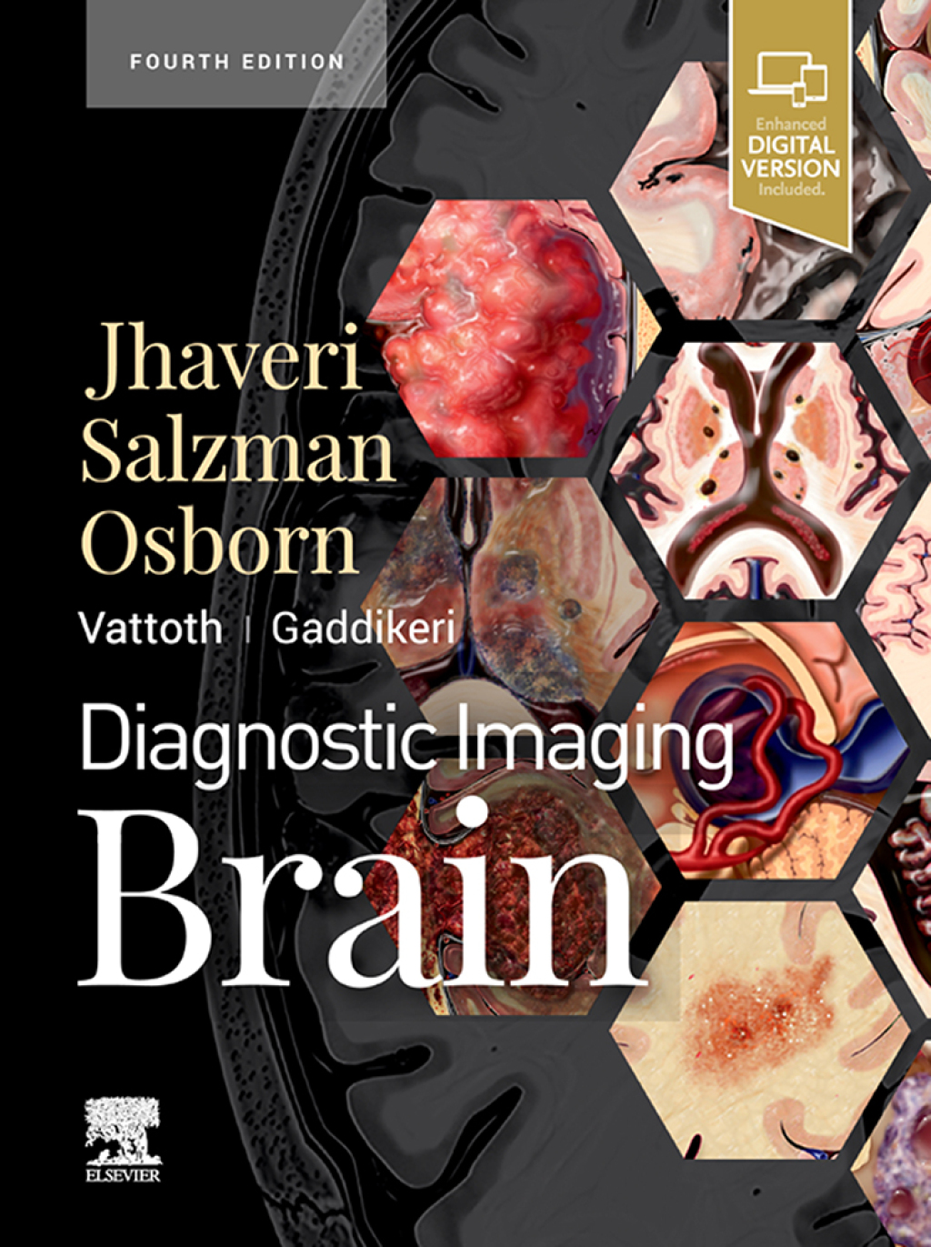Diagnostic Imaging: Brain E-Book 4th Edition