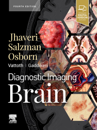 Imagen de portada: Diagnostic Imaging: Brain E-Book 4th edition 9780323756204