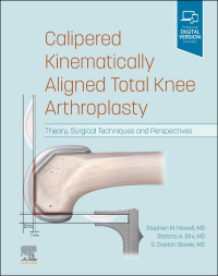 Imagen de portada: Calipered Kinematically aligned Total Knee Arthroplasty 9780323756266