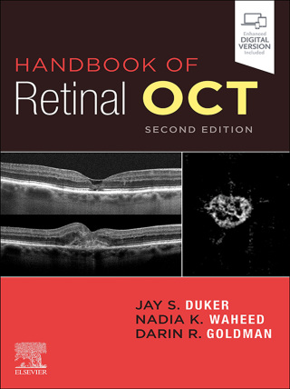Imagen de portada: Handbook of Retinal OCT: Optical Coherence Tomography 2nd edition 9780323757720