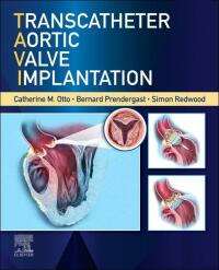 Cover image: Transcatheter Aortic Valve Implantation 9780323757928