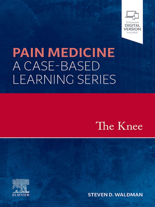 Cover image: The Knee 9780323762588
