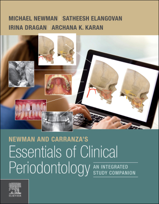 Cover image: Newman and Carranza's Essentials of Clinical Periodontology E-Book 1st edition 9780323754569