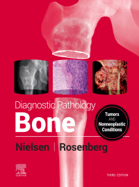 表紙画像: Diagnostic Pathology: Bone 3rd edition 9780323765336