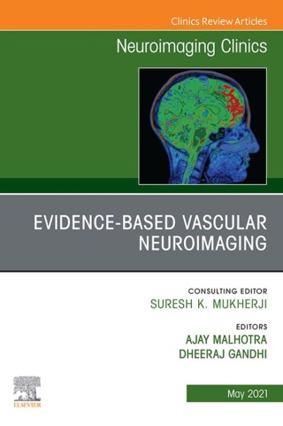 Imagen de portada: Evidence-Based Vascular Neuroimaging, An Issue of Neuroimaging Clinics of North America 9780323775519