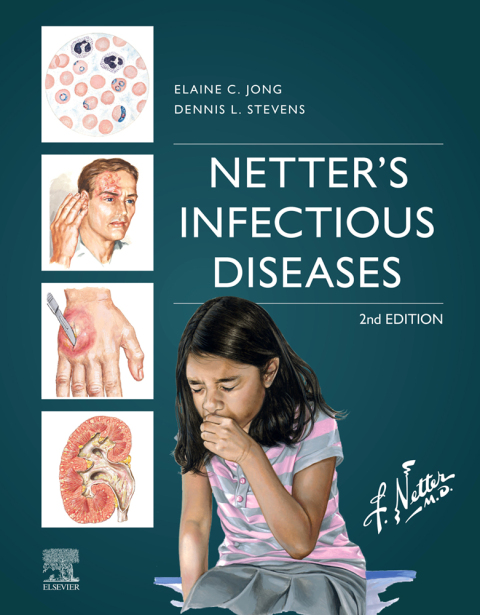 Netter's Infectious Diseases, 2nd Edition - FULL INSTANT DOWNLOAD | PDF DOCX EPUB
