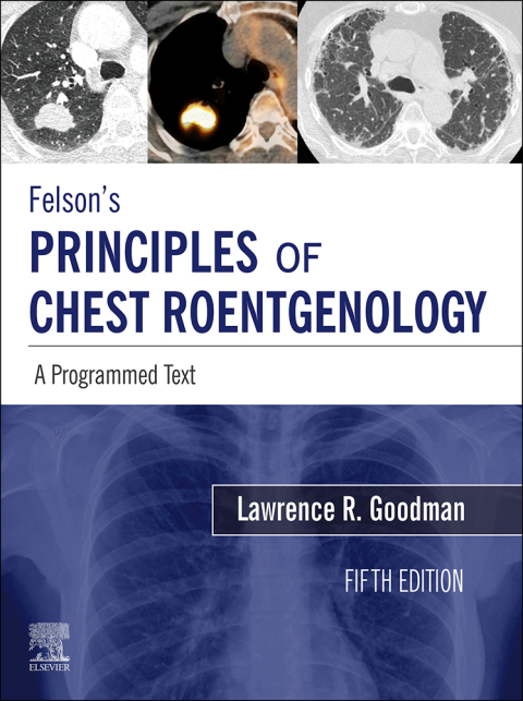 Felson's Principles of Chest Roentgenology : A Programmed Text, 5th Edition - FULL INSTANT DOWNLOAD | PDF DOCX EPUB