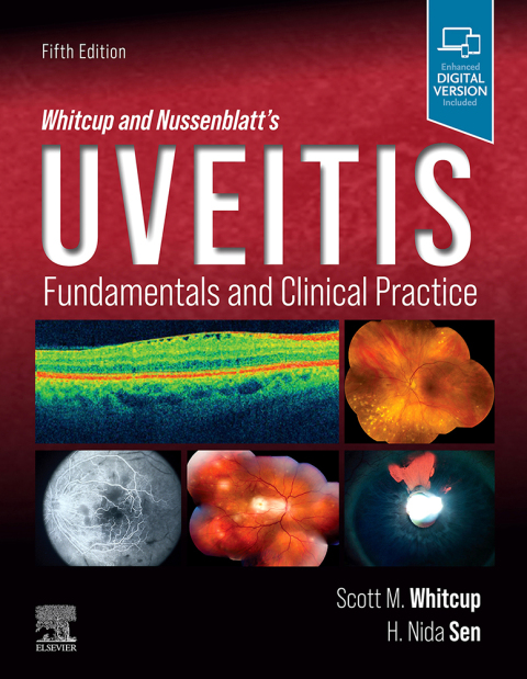 Whitcup and Nussenblatt's Uveitis: Fundamentals and Clinical Practice, 5th Edition - FULL INSTANT DOWNLOAD | PDF DOCX EPUB