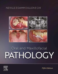Immagine di copertina: Oral and Maxillofacial Pathology 5th edition 9780323789813