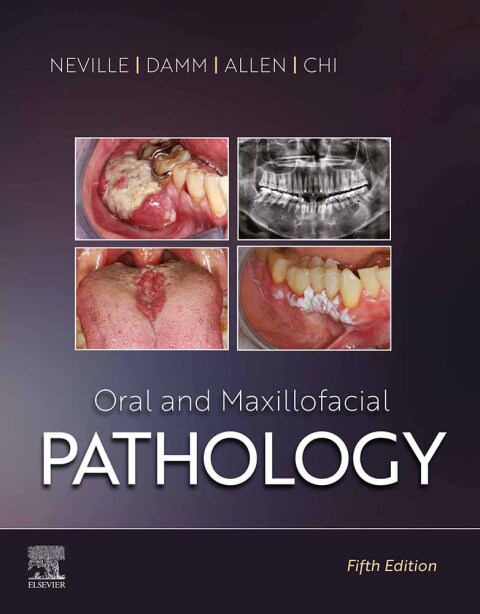 Oral and Maxillofacial Pathology, 5th Edition - FULL INSTANT DOWNLOAD | PDF DOCX EPUB
