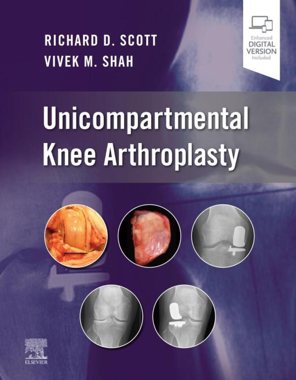 ISBN 9780323790109 product image for Unicompartmental Knee Arthroplasty  E-Book (eBook) | upcitemdb.com