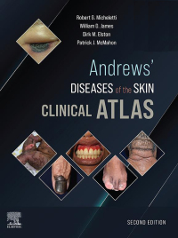 Imagen de portada: Andrews' Diseases of the Skin Clinical Atlas 2nd edition 9780323790130