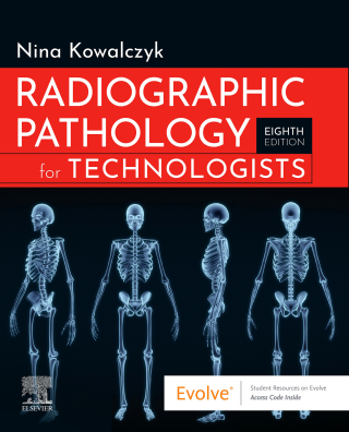 Immagine di copertina: Radiographic Pathology for Technologists 8th edition 9780323791298