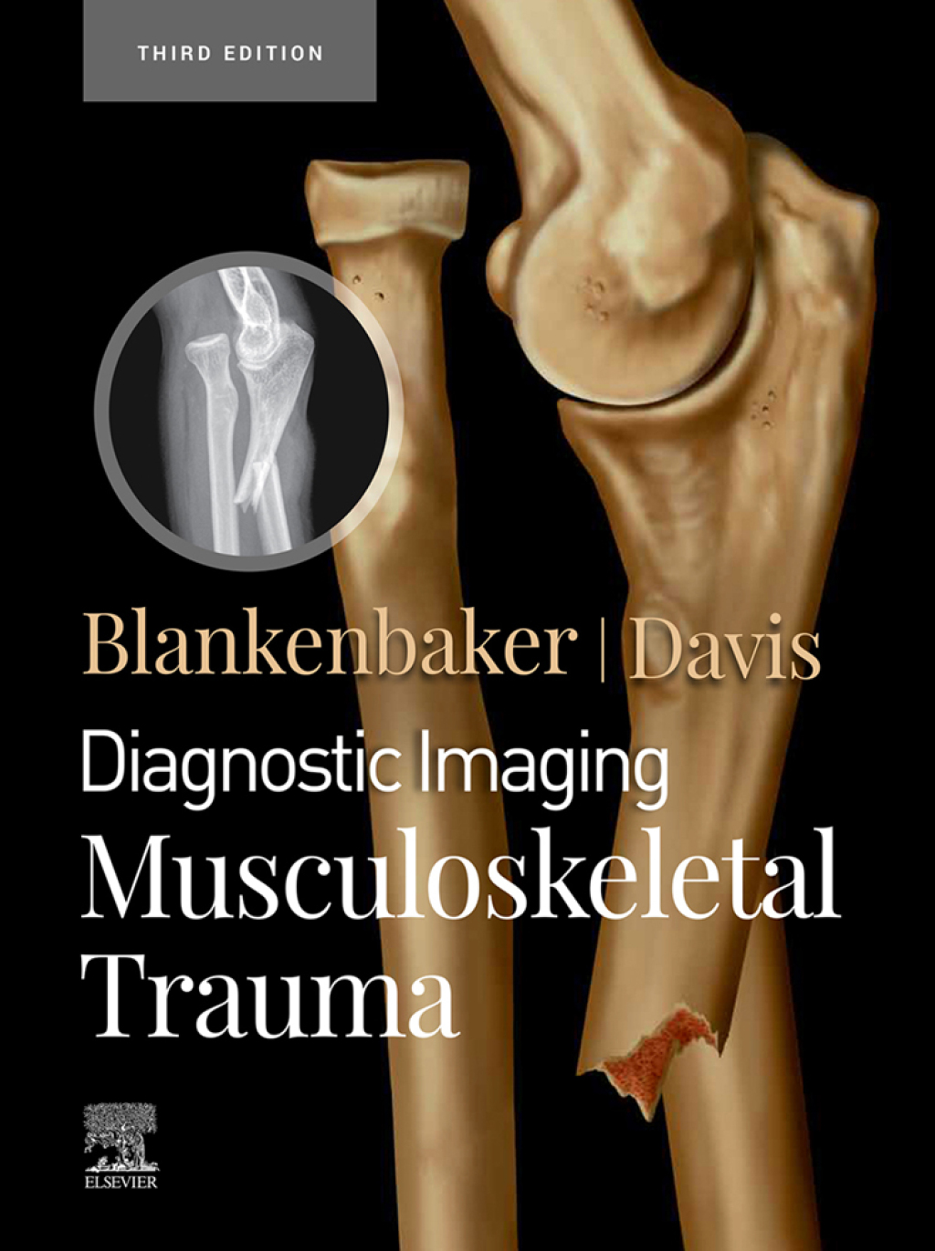 Diagnostic Imaging: Musculoskeletal Trauma,E-Book 3rd Edition
